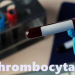 thrombocyta